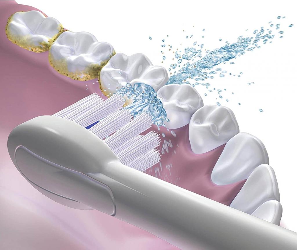 Waterpik Sonic-Fusion Zahnbürste beim Putzen der Zähne